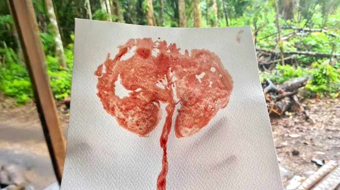 Impression colorée du placenta, art placentaire